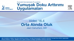 Video 16.4: Orta Alında Oluk