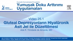 Video 25.1: Gluteal Depresyonların Hiyalüronik Asit Jel ile Düzeltilmesi