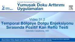 Video 31.2: Temporal Bölgeye Dolgu Enjeksiyonu Sırasında Pozitif Kan Reflü Testi
