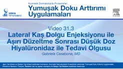 Video 31.3: Lateral Kaș Dolgu Enjeksiyonu ile Așırı Düzeltme Sonrası Düșük Doz Hiyalüronidaz ile Tedavi Olgusu