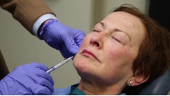 Cosmetic Facial Fillers