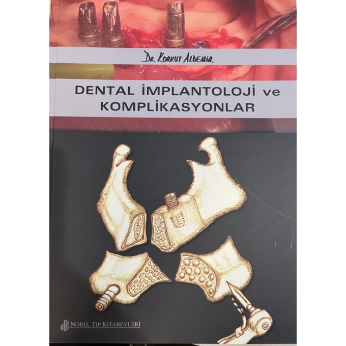 Dental Implantoloji Ve Komplikasyonlar