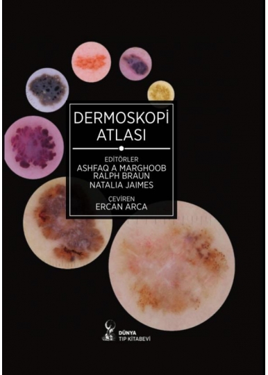 Dermoskopi Atlası