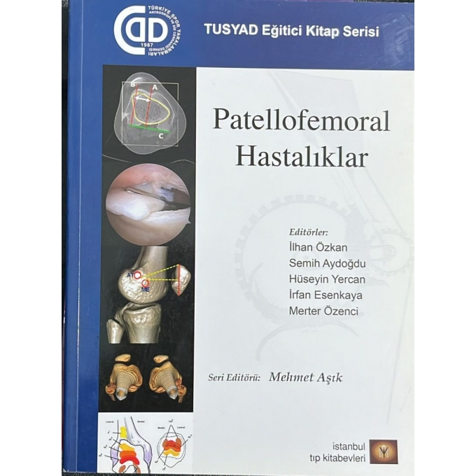 Patellofemoral Hastalıklar - Mehmet Aşık