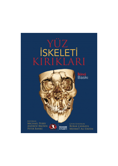 Yüz İskeleti Kırıkları