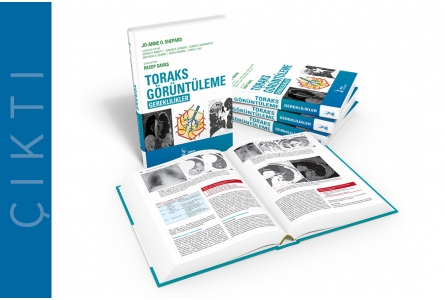 Toraks Görüntüleme: Gereklilikler