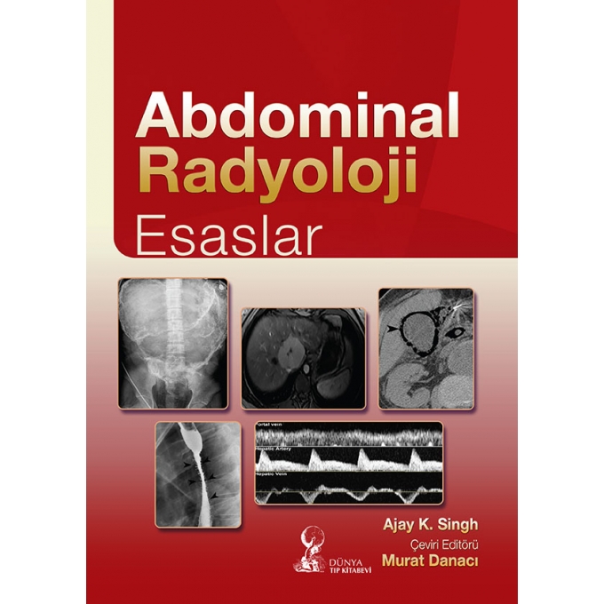 Abdominal Radyoloji: Esaslar