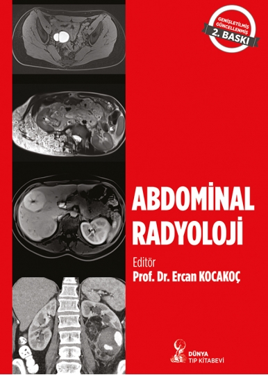 Abdominal Radyoloji 2. Baskı