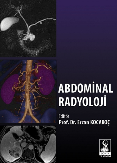 Abdominal Radyoloji