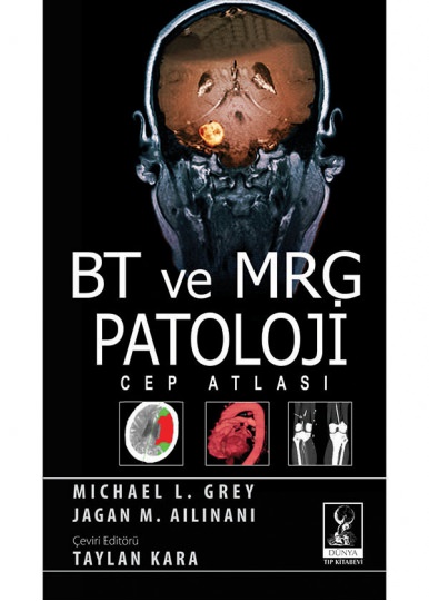 BT ve MRG Patoloji Cep Atlası
