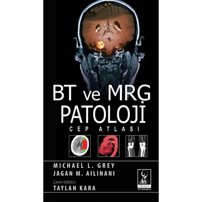 BT ve MRG Patoloji Cep Atlası