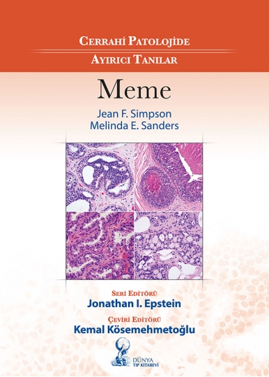 Cerrahi Patolojide Ayırıcı Tanılar: Meme