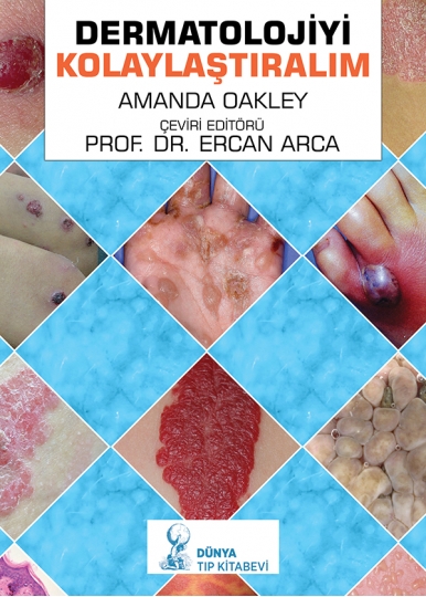 Dermatolojiyi Kolaylaştıralım