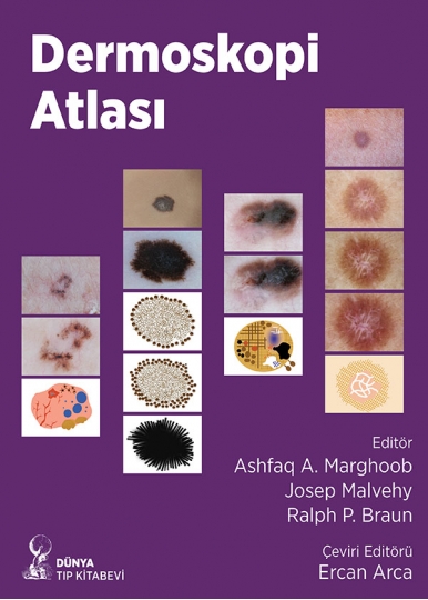 Dermoskopi Atlası