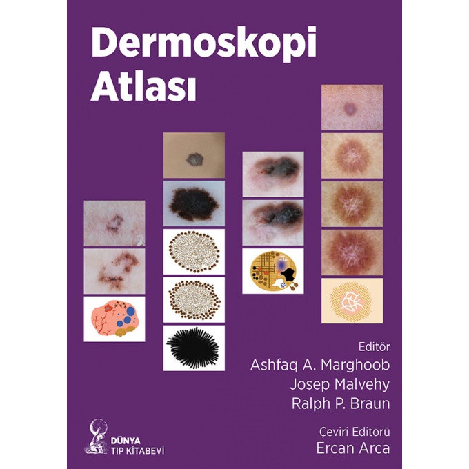 Dermoskopi Atlası