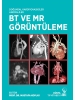 Doğumsal Kardiyovasküler Anomaliler BT ve MR Görüntüleme