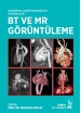 Doğumsal Kardiyovasküler Anomaliler BT ve MR Görüntüleme