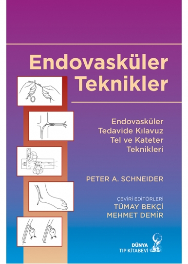 Endovasküler Teknikler: Endovasküler Tedavide Kılavuz Tel ve Kateter Teknikleri