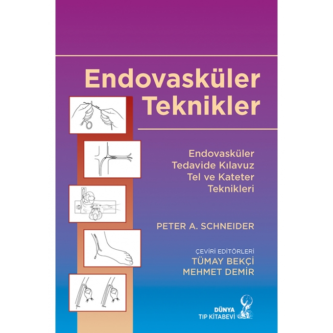 Endovasküler Teknikler: Endovasküler Tedavide Kılavuz Tel ve Kateter Teknikleri