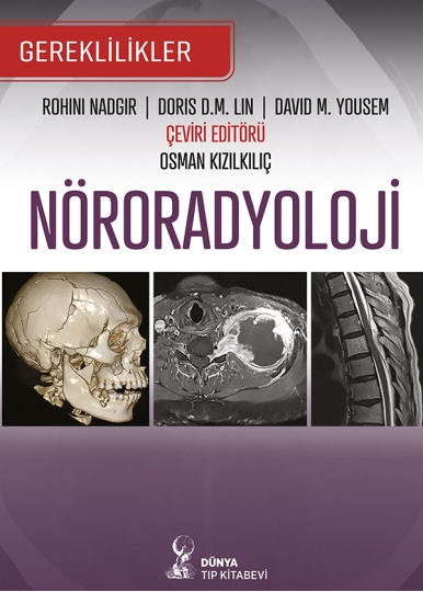 Nöroradyoloji: Gereklilikler