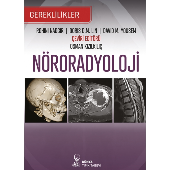 Nöroradyoloji: Gereklilikler