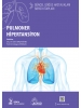 Pulmoner Hipertansiyon: Güncel Göğüs Hastalıkları Serisi Kitapları