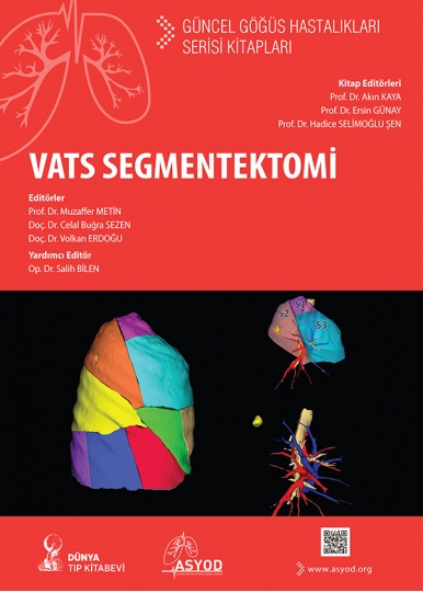 VATS Segmentektomi: Güncel Göğüs Hastalıkları Serisi Kitapları