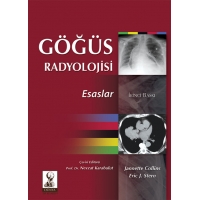 Göğüs Radyolojisi: Esaslar