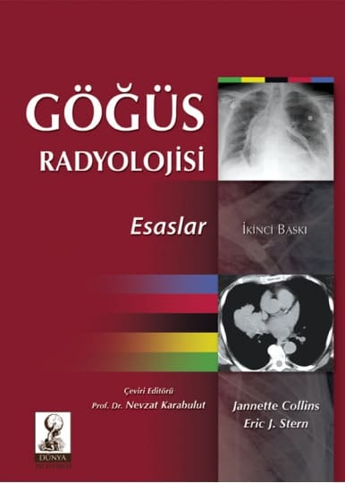 Göğüs Radyolojisi: Esaslar