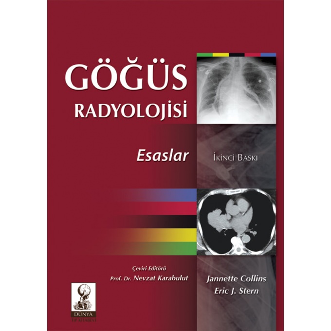 Göğüs Radyolojisi: Esaslar