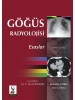 Göğüs Radyolojisi: Esaslar