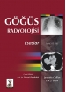 Göğüs Radyolojisi: Esaslar