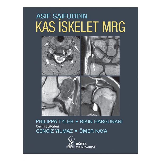 Kas İskelet MRG