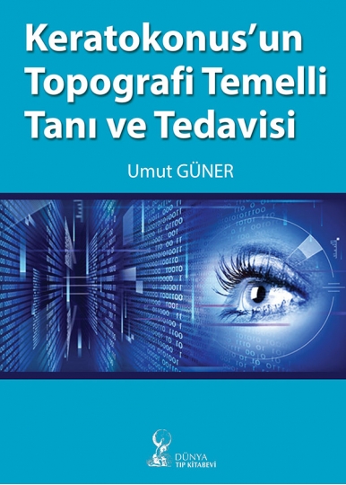 Keratokonusun Topografi Temelli Tanı ve Tedavisi