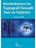 Keratokonusun Topografi Temelli Tanı ve Tedavisi