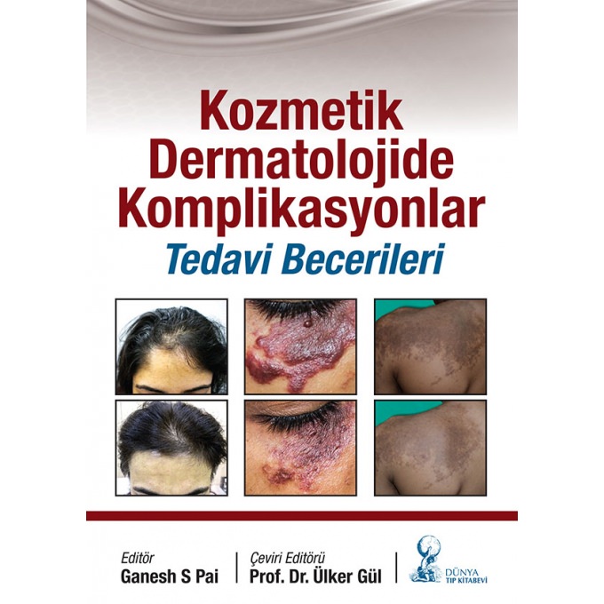Kozmetik Dermatolojide Komplikasyonlar: Tedavi Becerileri