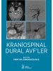 Kraniospinal Dural AVF’ler