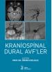 Kraniospinal Dural AVF’ler