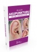 Kulak Akupunkturu