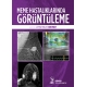 Meme Hastalıklarında Görüntüleme