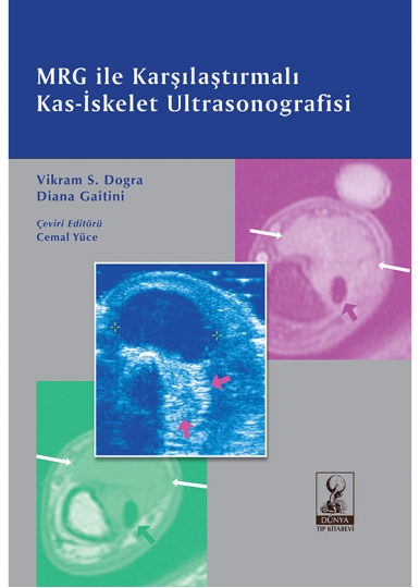 MRG ile Karşılaştırmalı Kas-İskelet Ultrasonografisi