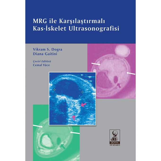 MRG ile Karşılaştırmalı Kas-İskelet Ultrasonografisi