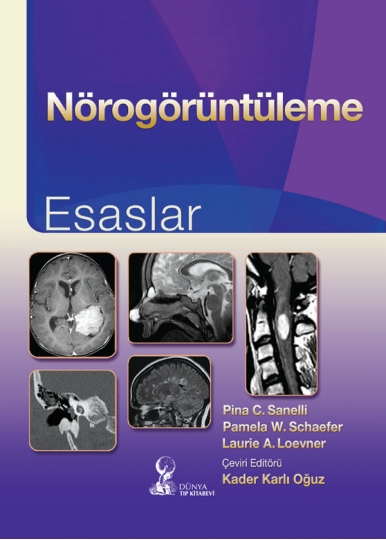 Nörogörüntüleme: Esaslar