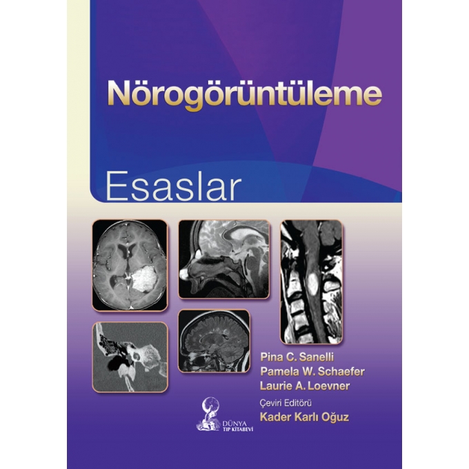 Nörogörüntüleme: Esaslar