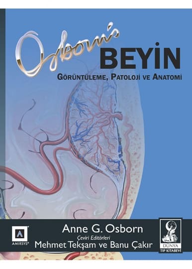 Osborn Beyin: Görüntüleme, Patoloji ve Anatomi