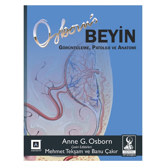 Osborn Beyin: Görüntüleme, Patoloji ve Anatomi