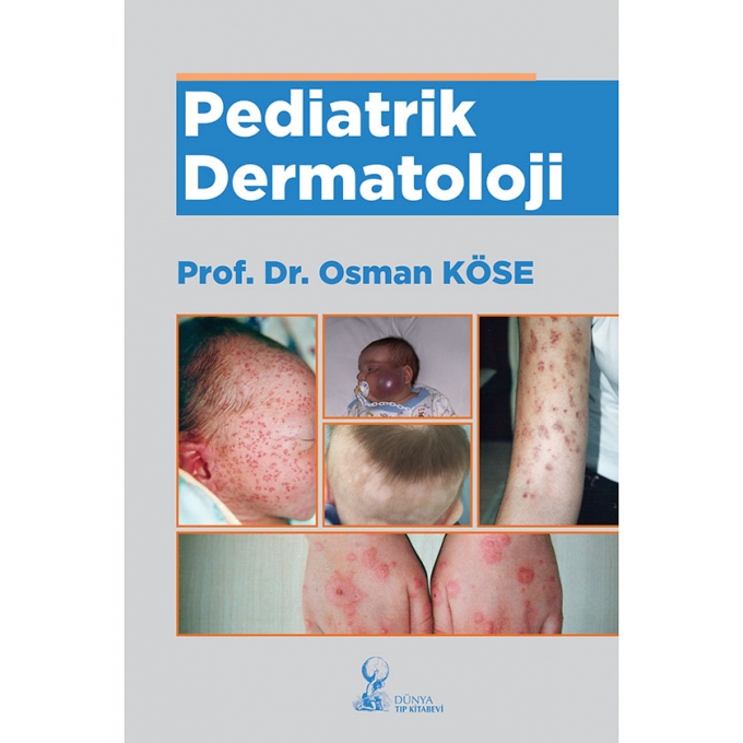 Pediatrik Dermatoloji