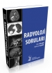 Radyoloji Soruları