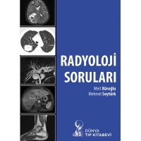 Radyoloji Soruları