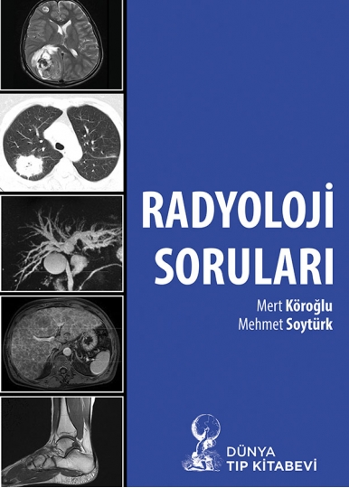 Radyoloji Soruları